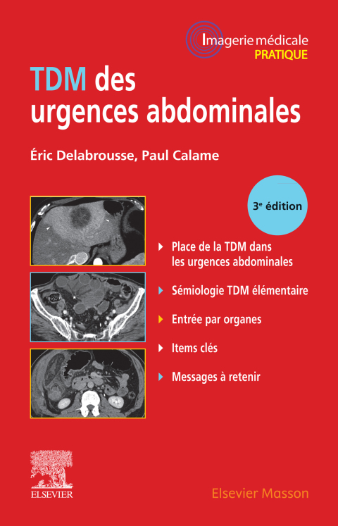 Cover image for book TDM des urgences abdominales