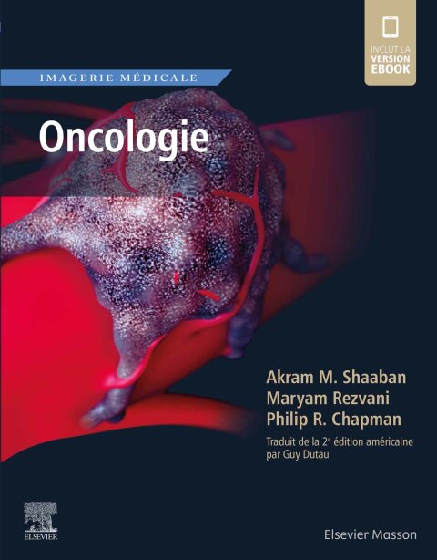 Imagerie médicale : Oncologie 