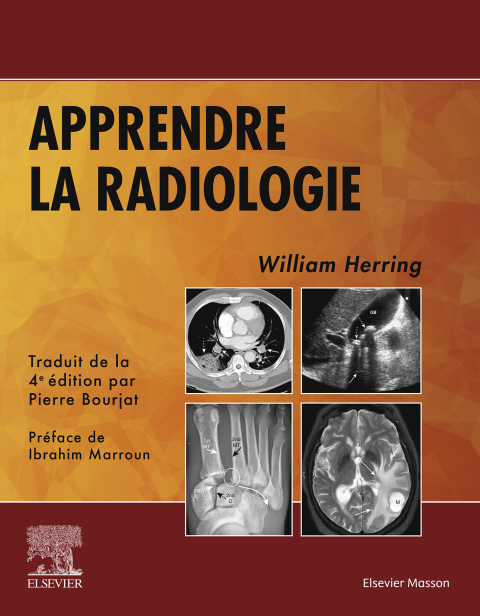 Cover image for book Apprendre la radiologie