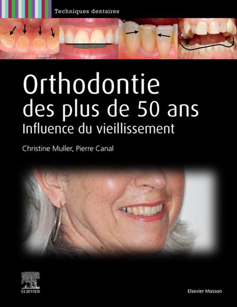 Cover image for book Orthodontie des plus de 50 ans