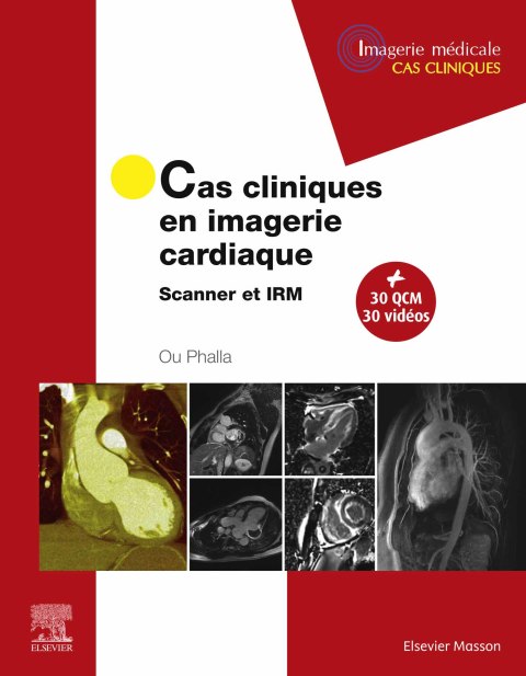 Cover image for book Cas cliniques en imagerie cardiaque