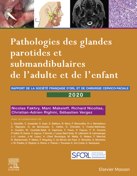 Cover image for book Pathologies des glandes parotides et submandibulaires de l'adulte et de l'enfant
