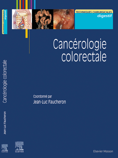 Cover image for book Cancérologie colorectale