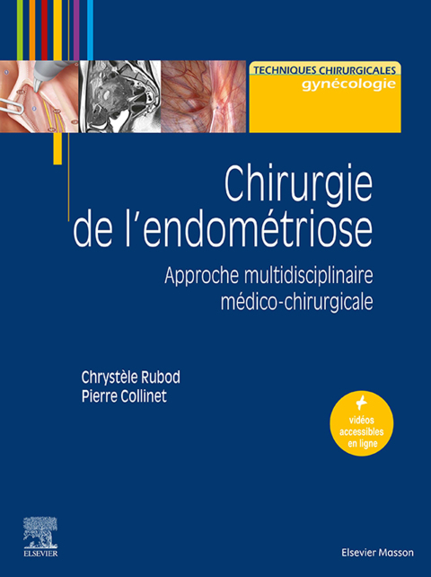 Cover image for book Chirurgie de l'endométriose