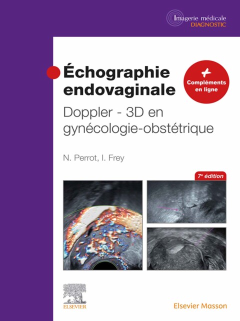 Cover image for book Échographie endovaginale Doppler - 3D