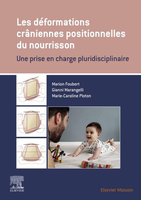 Cover image for book Les déformations crâniennes positionnelles du nourrisson