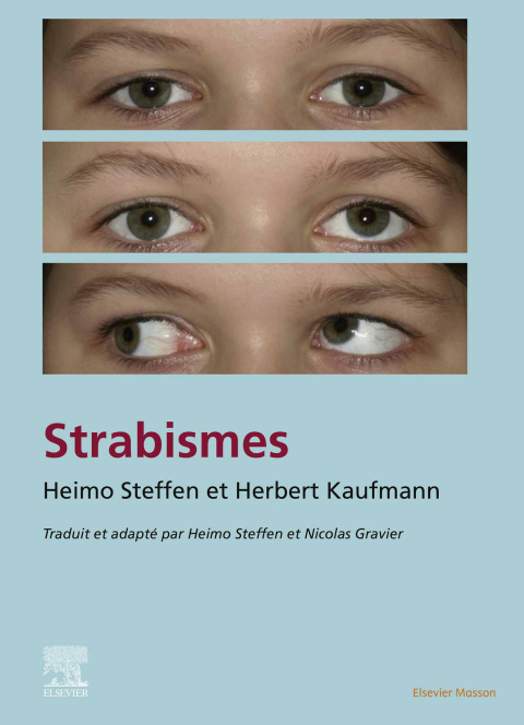 Cover image for book Strabisme