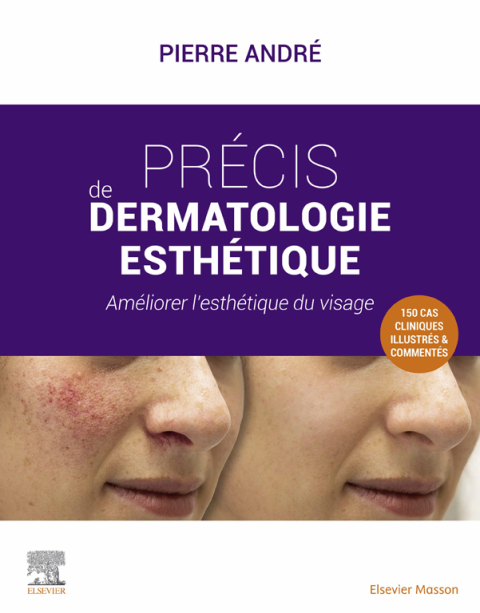 Cover image for book Précis de dermatologie esthétique