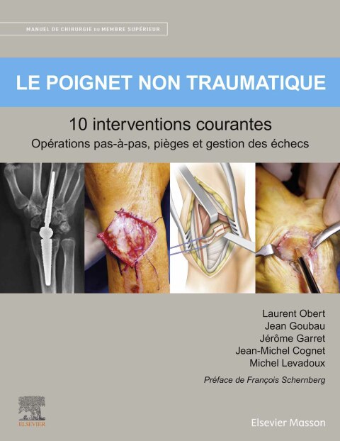 Cover image for book Le poignet non traumatique 10 interventions courantes