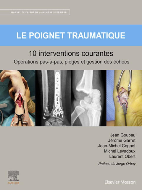 Cover image for book Le poignet traumatique 10 interventions courantes