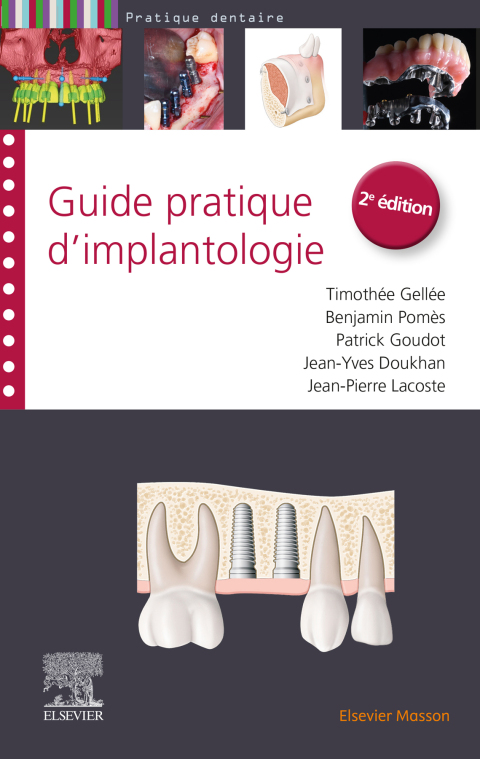 Guide pratique d'implantologie 