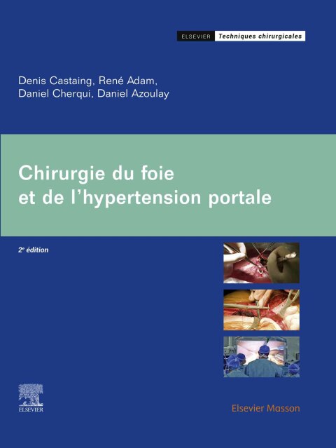 Cover image for book Chirurgie du foie et de l'hypertension portale