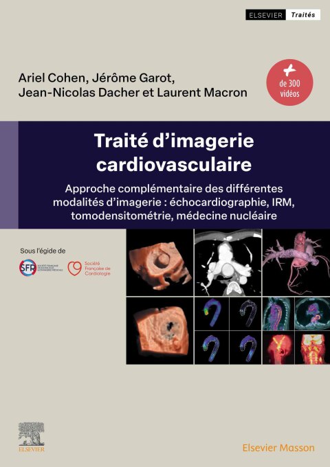 TraitÃ© d'imagerie cardiovasculaire 