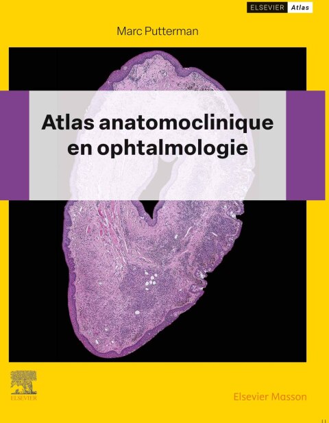 Cover image for book Atlas anatomoclinique en ophtalmologie