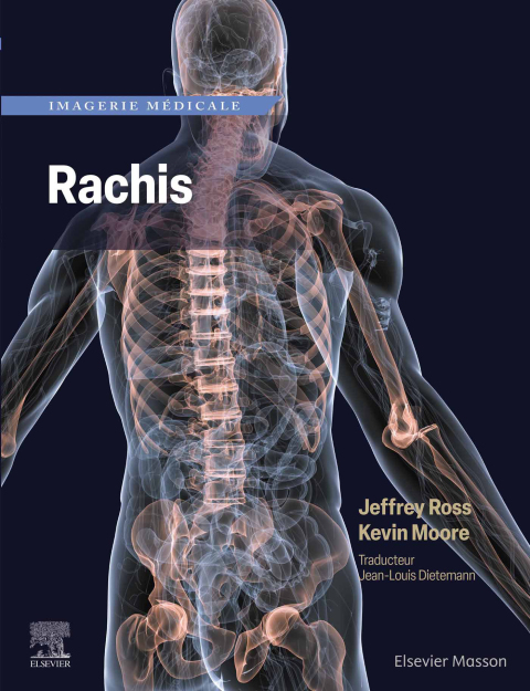 Imagerie mÃ©dicale : Rachis 