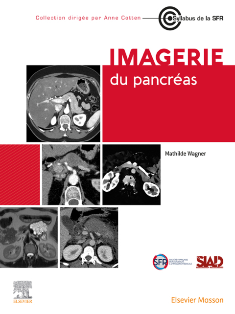 Cover image for book Imagerie du pancréas