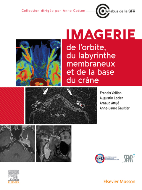 Cover image for book Imagerie de l’orbite, du labyrinthe membraneux et de la base du crâne