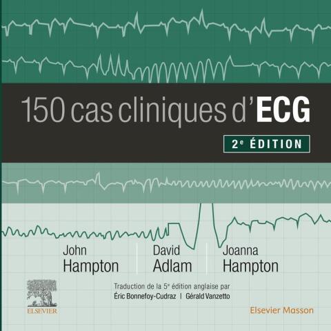Cover image for book 150 cas cliniques d'ECG