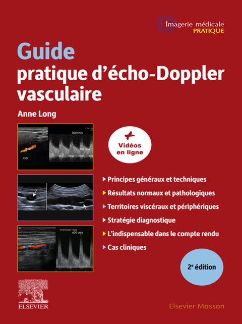Cover image for book Guide pratique d'écho-Doppler vasculaire