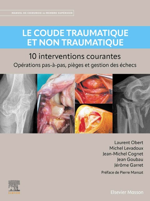 Cover image for book Le coude traumatique et non traumatique - 10 interventions courantes