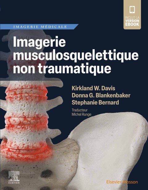 Cover image for book Imagerie musculosquelettique non traumatique