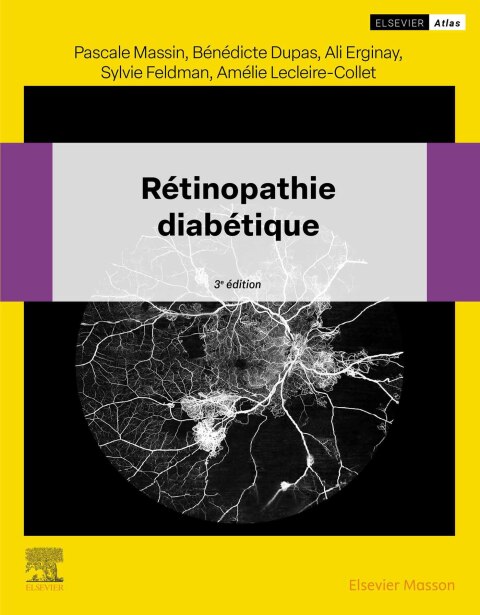 Cover image for book Rétinopathie diabétique