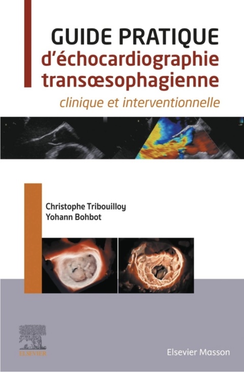 Cover image for book Guide pratique d'échocardiographie transœsophagienne