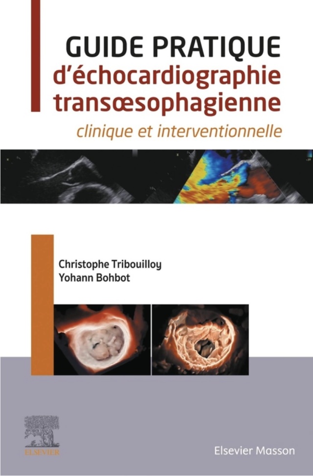 Guide pratique d'échocardiographie transœsophagienne