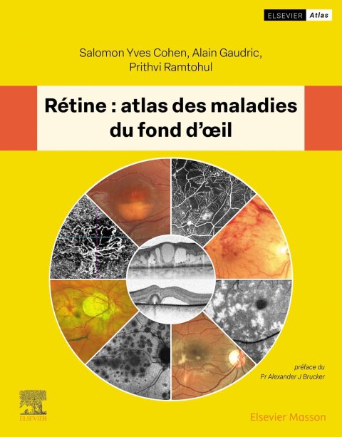 Cover image for book Rétine : atlas des maladies du fond d'oeil