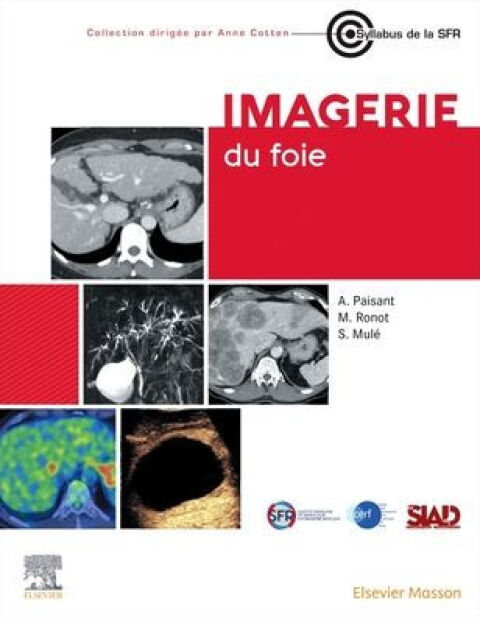 Cover image for book Imagerie du foie