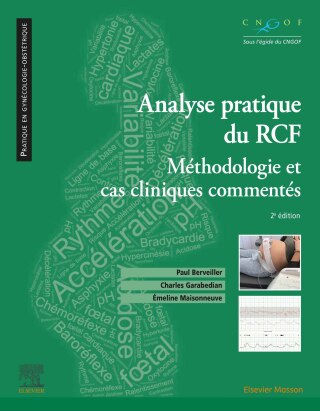 Analyse pratique du RCF : rythme cardiaque fœtal