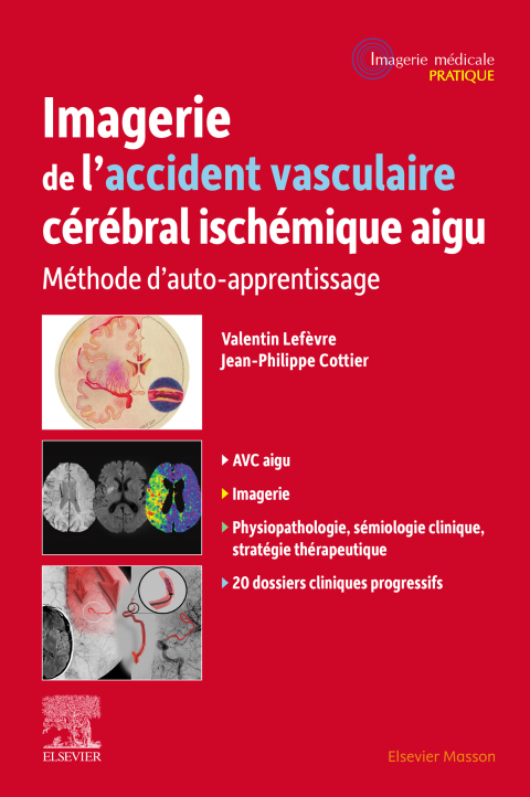 Cover image for book Imagerie de l'accident vasculaire cérébral ischémique aigu