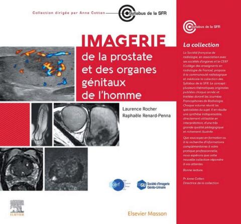 Cover image for book Imagerie du pelvis masculin