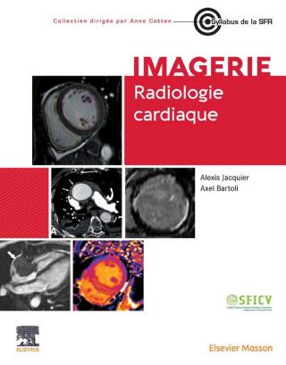 Radiologie cardiaque