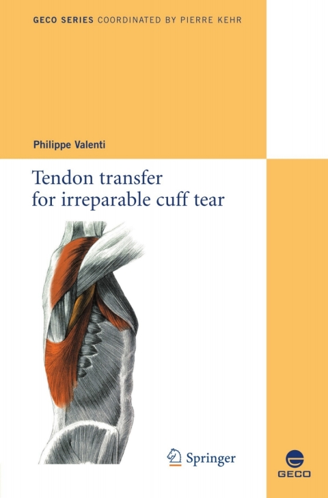 Cover image for book Tendon transfer for irreparable cuff tear