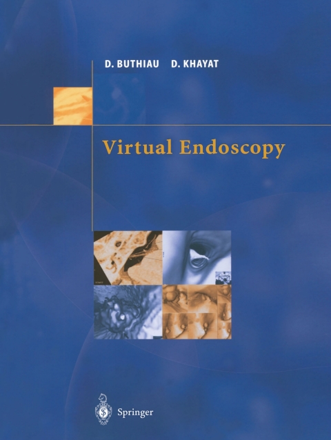 Cover image for book Virtual Endoscopy