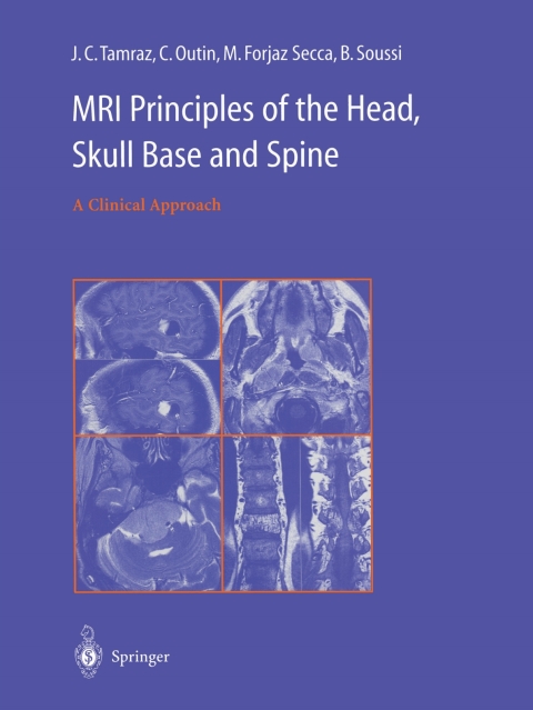 Cover image for book MRI Principles of the Head, Skull Base and Spine
