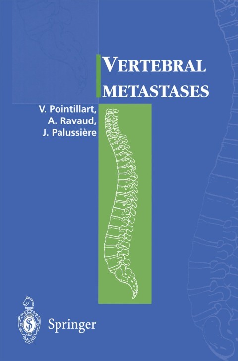 Cover image for book Vertebral metastases