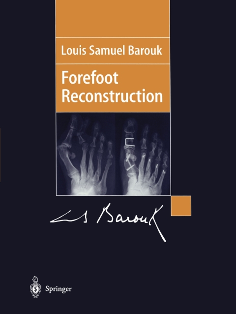Cover image for book Forefoot Reconstruction