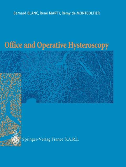 Cover image for book Office and Operative Hysteroscopy