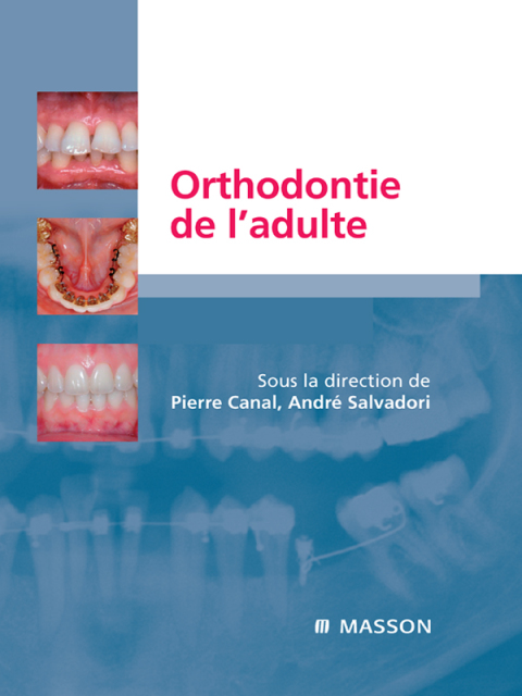 Cover image for book Orthodontie de l’adulte