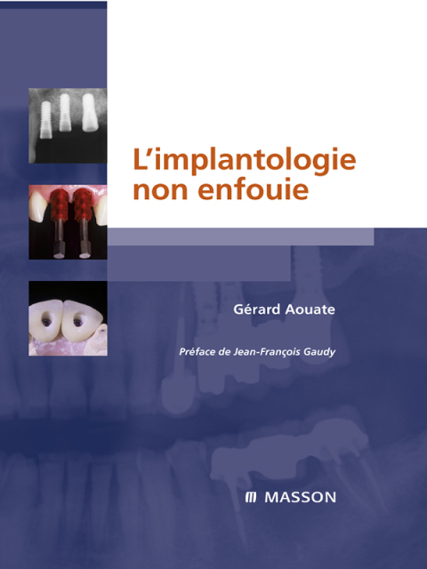 Cover image for book L'implantologie non enfouie
