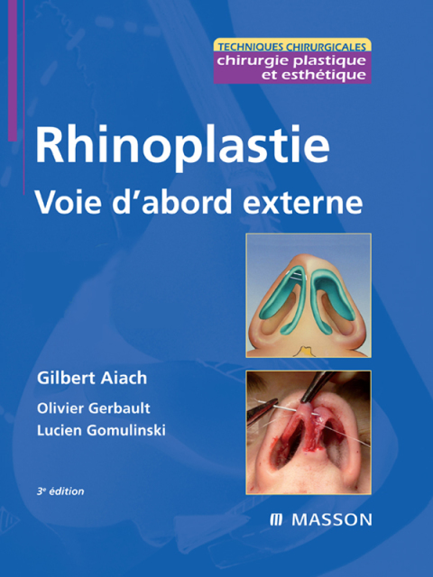 Cover image for book Rhinoplastie. Voie d'abord externe