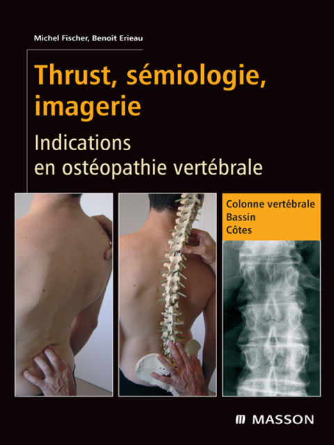 Cover image for book Thrust, sémiologie, imagerie