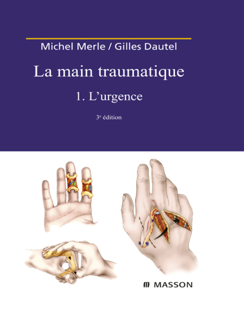 Cover image for book La Main traumatique. Tome 1. L'Urgence