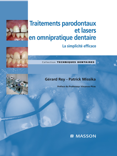 Cover image for book Traitements parodontaux et lasers en omnipratique dentaire