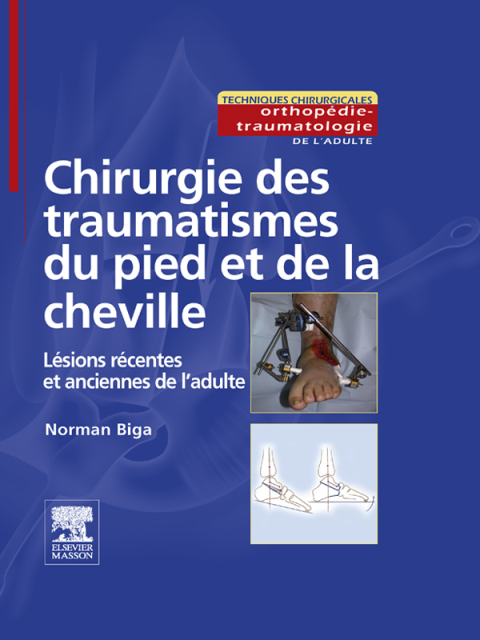 Cover image for book Chirurgie des traumatismes du pied et de la cheville