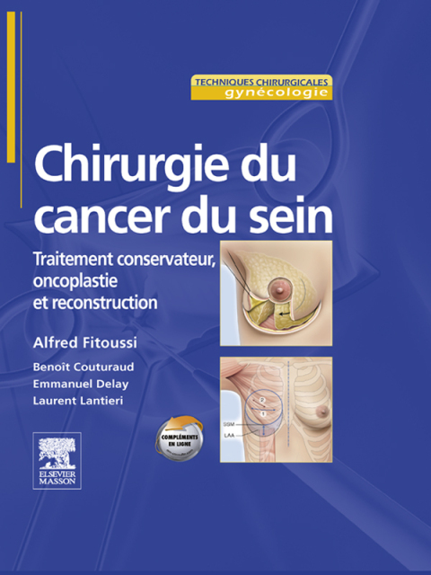 Cover image for book Chirurgie du cancer du sein
