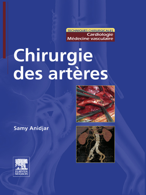 Cover image for book Chirurgie des artères