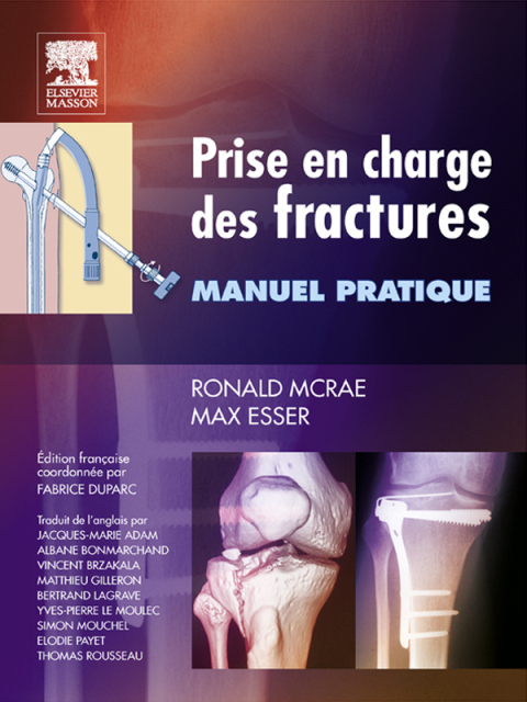 Cover image for book Prise en charge des fractures